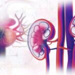 Диабетическая нефропатия